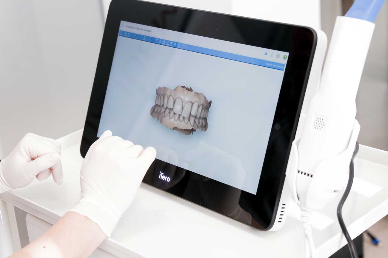 Mappatura-dentale-Ferraraa