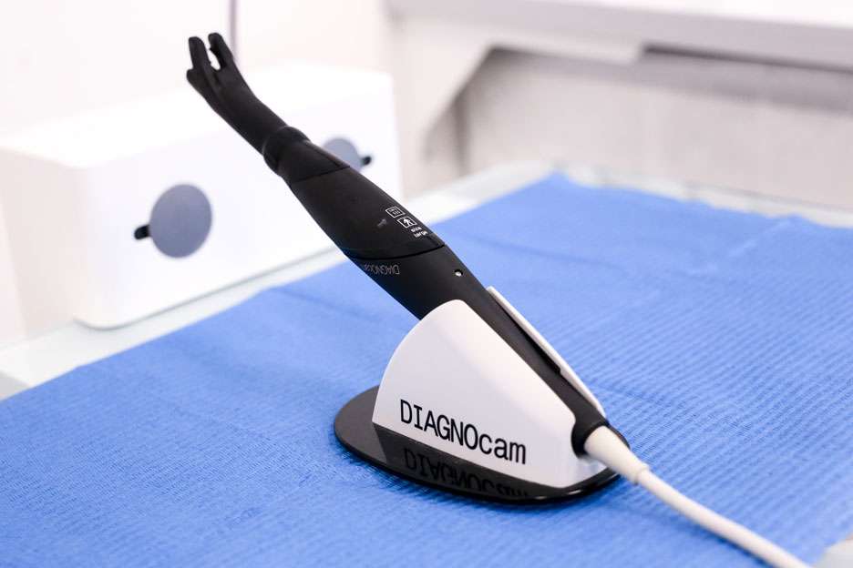 20-DiagnoCam-diagnosi-carie-senza-radiazioni-x Erresse Ferrara-
